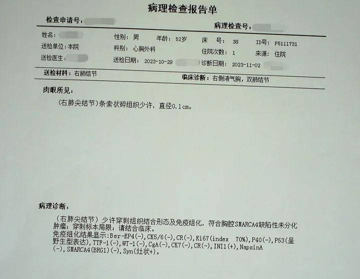 罕见肺结节病例:胸部smarca4缺失的未分化肿瘤