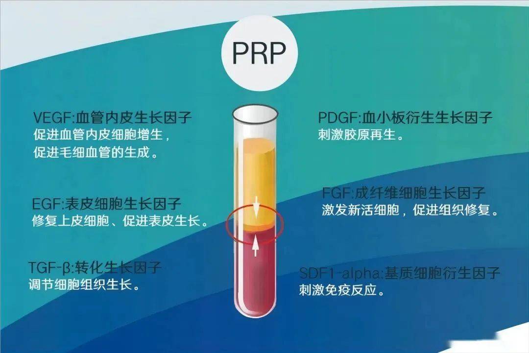 新技術新膝望,prp治療——早期膝關病患者的福音_組織_局部_血小板