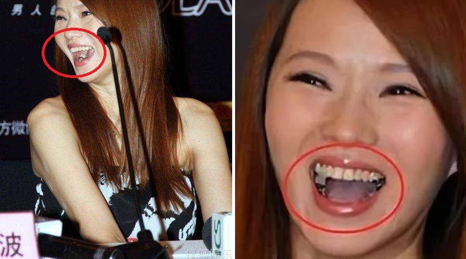 大烂牙三白眼,蒜头鼻塌屁股,那些女明星拼命掩饰的硬伤