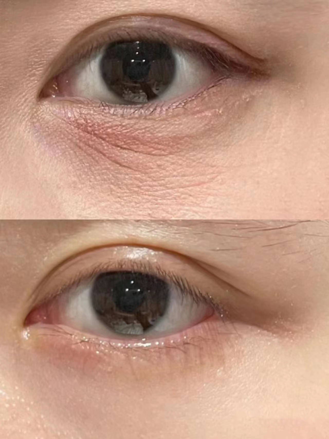 眼霜哪个牌子抗皱去皱效果最好?