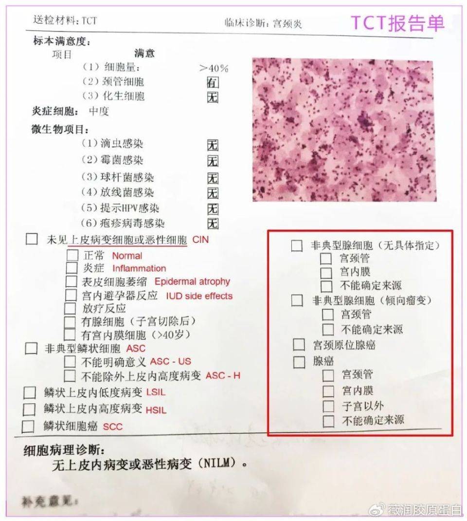 癌症检验报告单图片