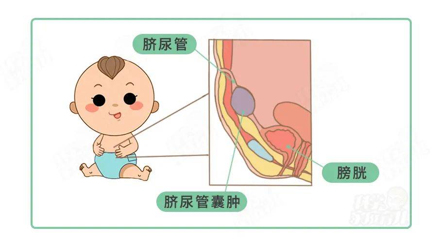 孩子肚子疼脐贴有用吗