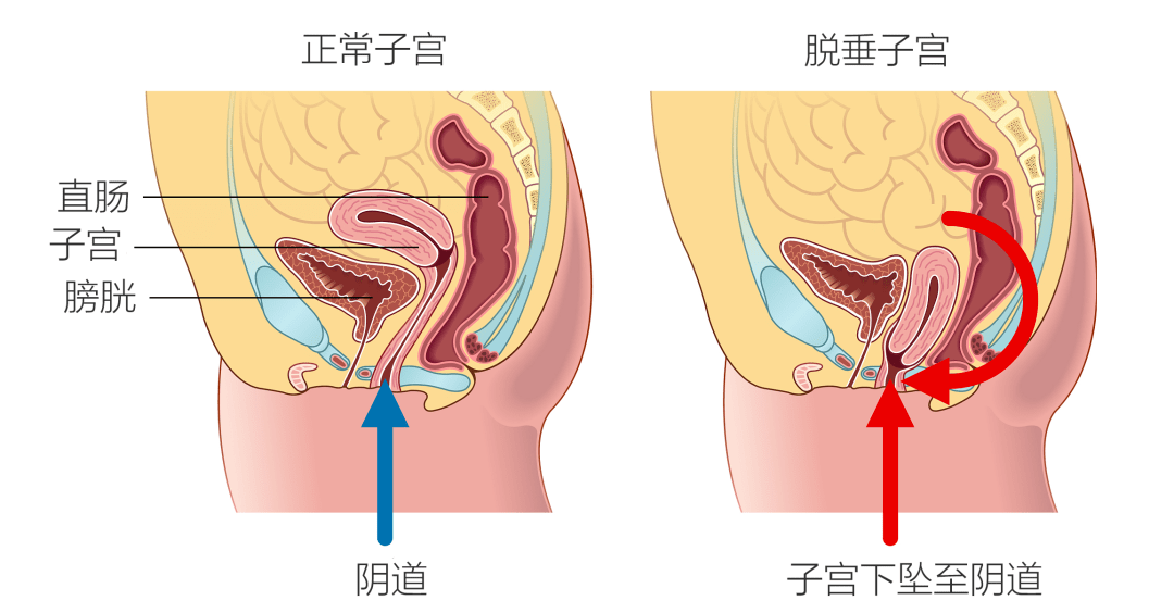 子宫附件正常图片