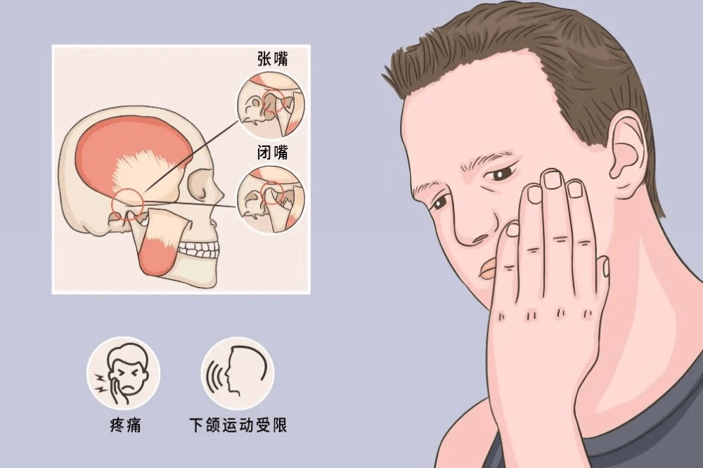 一陣寒風吹過,張不開口了_關節_下頜_疾病