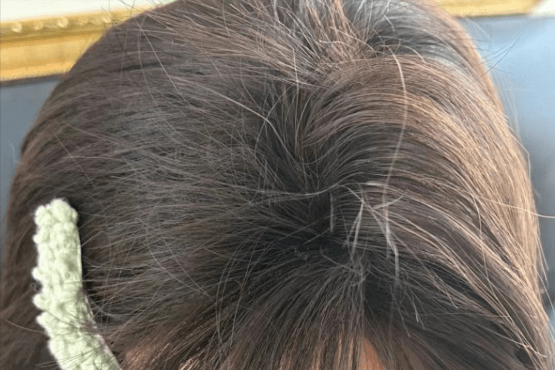 养发90天终于逆天改"头",光明顶秒变浓密顺滑秀发!_方法_头发_营养