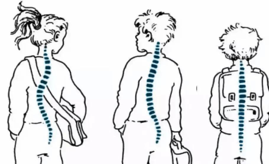 五大常見兒童青少年不良體態及自測方式_影響_問題_脊柱