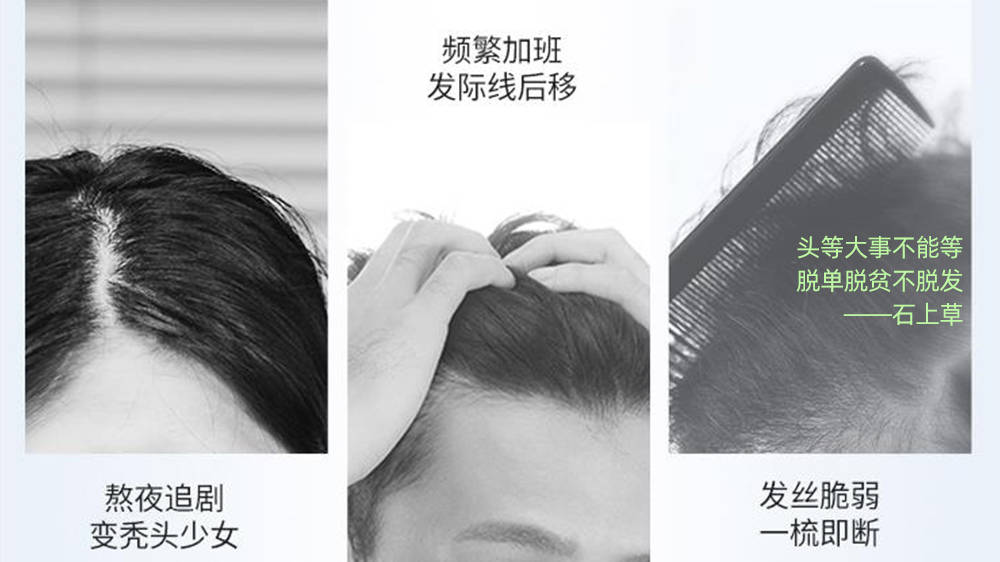 脱发洗什么洗发水最好?防脱产品真的不需要花大价钱!_头发_头皮_遗传