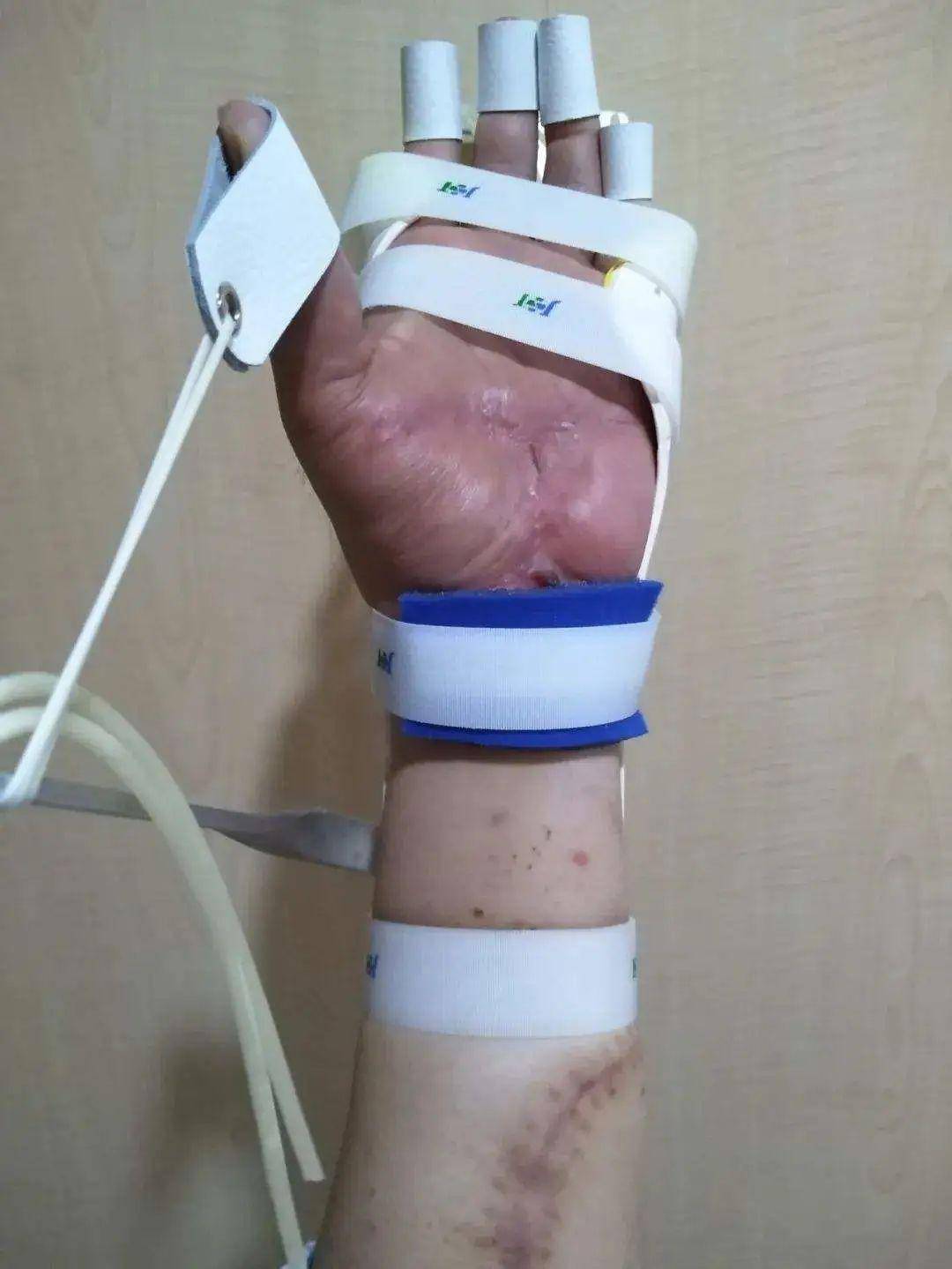 医生陶勇被砍100多天后,"我保住了他的眼睛,他却要杀我!