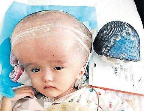 大头娃娃阴霾12年不散别让三聚氰胺的噩梦卷土重来