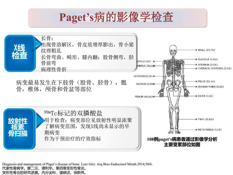 一文搞定paget骨病诊治详解