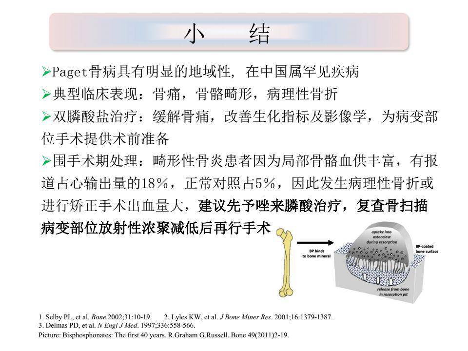 一文搞定paget骨病诊治详解