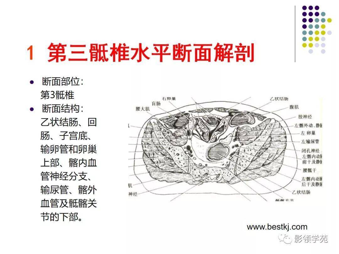女性盆腔水平断面解剖_医学