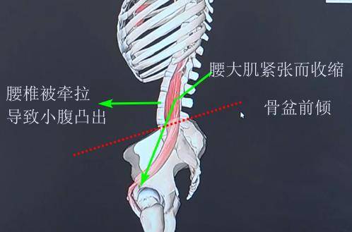 腰部酸痛一定是腰出了问题那可不一定腰大肌正在旁边偷笑呢