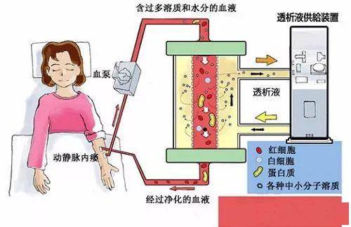 什么是透析充分性?