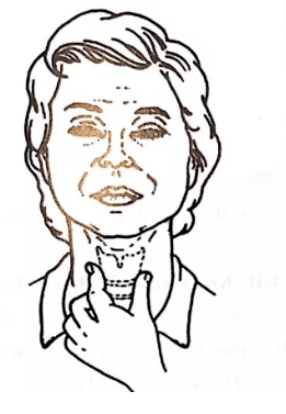 门德尔松手法:此法延长了吞咽时呼吸暂停时间,对于有呼吸系统疾病和