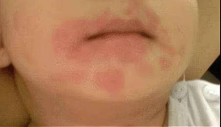 虽然芒果是好东西,但是吃多了对身体也有害,所以就算孩子再想吃,也要