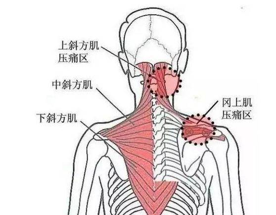 得了筋膜炎怎么办