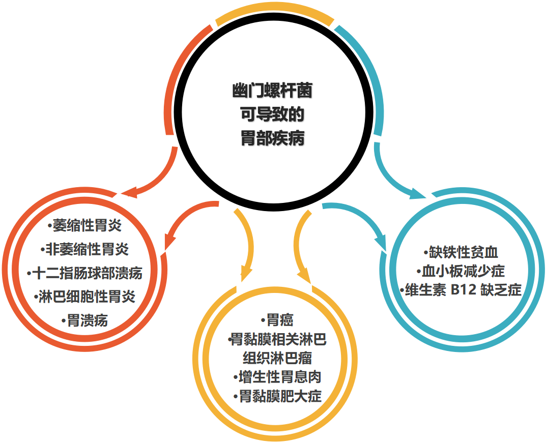 檢測出幽門螺桿菌,到底治不治?