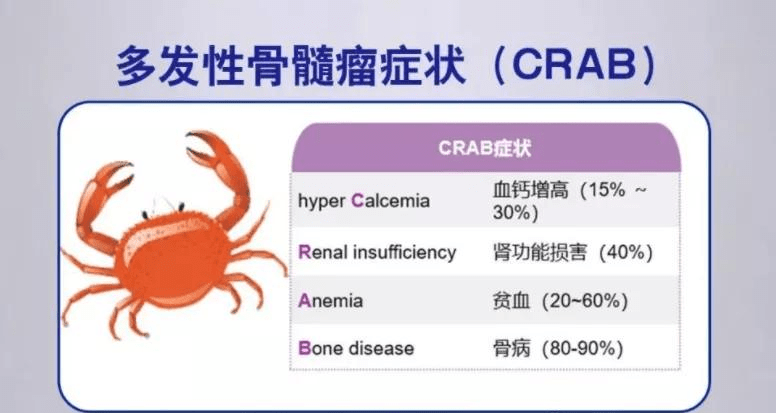 什么是多发性骨髓瘤的"crab"症状(螃蟹症状?_治疗