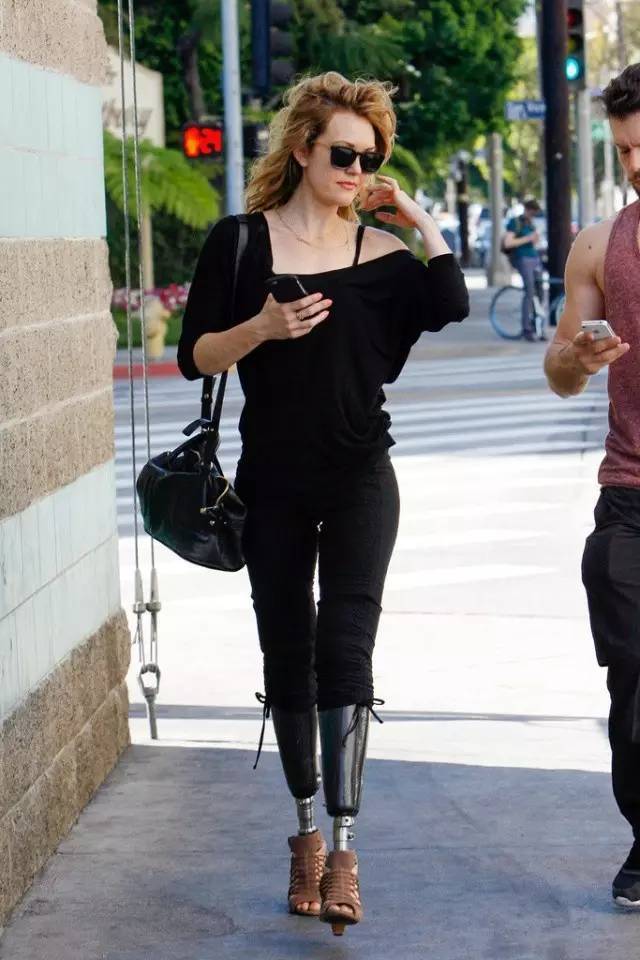 装上假肢后能否穿高跟鞋面对人生变故我们需要从容淡定