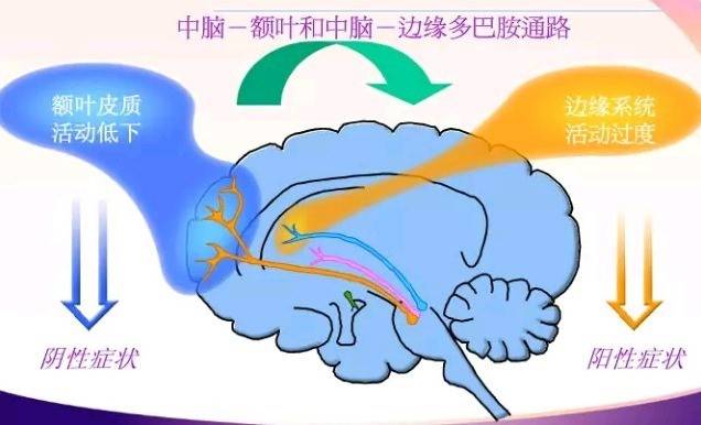 什么是精神分裂症阳性 5d3c399b9b0f47498bdc11c8a16d1bf5.jpeg