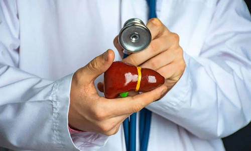 肝脏|肝纤维化是什么饮食导致的？做好这5件事，可预防