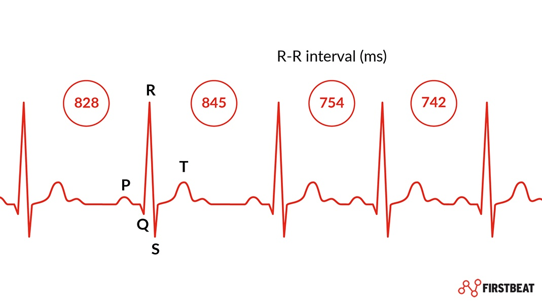 什么是心率变异性hrv及智能手表是怎么样测量hrv的