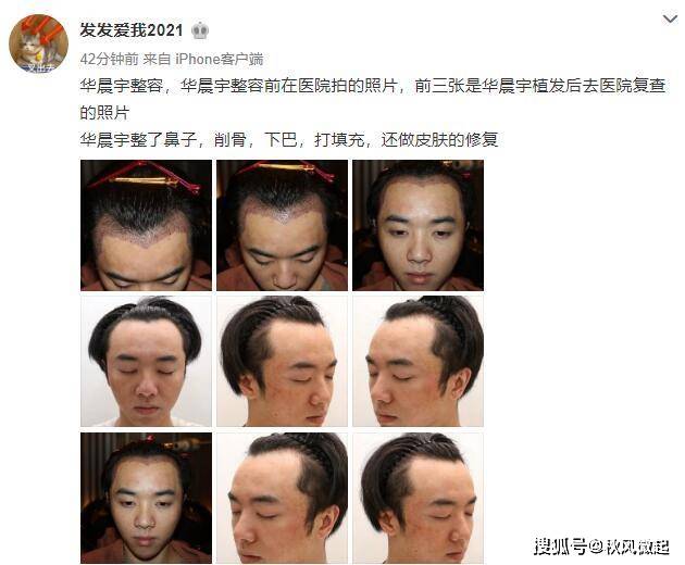 维权|网友晒视频自称是华晨宇老婆，爆料整容、植发，男方起诉维权