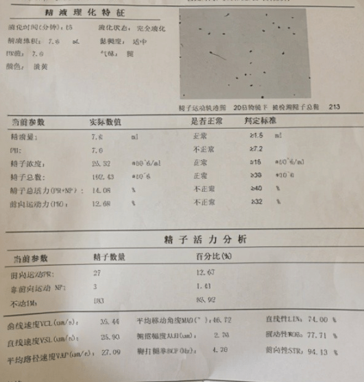 男生体检检查睾丸图片