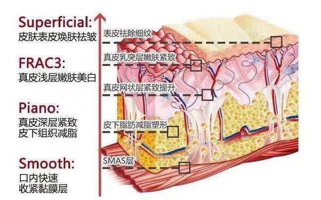 怎样才算是下颌线清晰 41336252109d4e28a2166afeec542143.jpeg