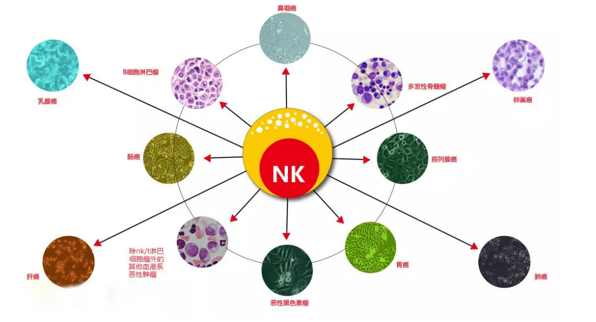 nk免疫細胞治療腫瘤八大優勢