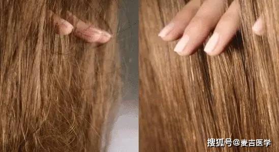 头皮|经常染发会“致癌”，真相到底是什么？记住4点可放心染发