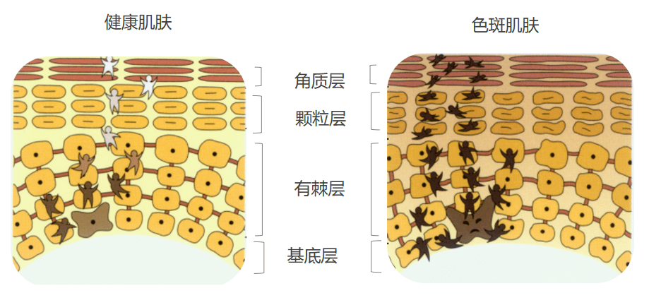 表皮层|秋季不补水 来年一脸斑