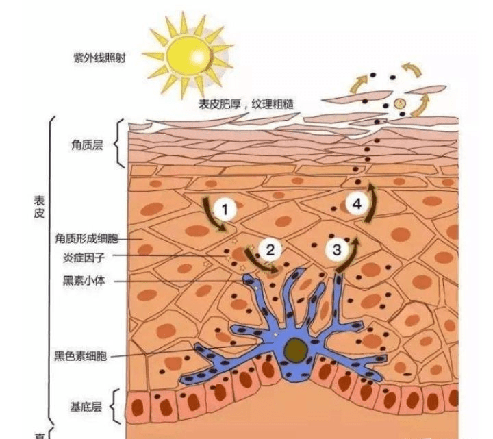 表皮层|秋季不补水 来年一脸斑