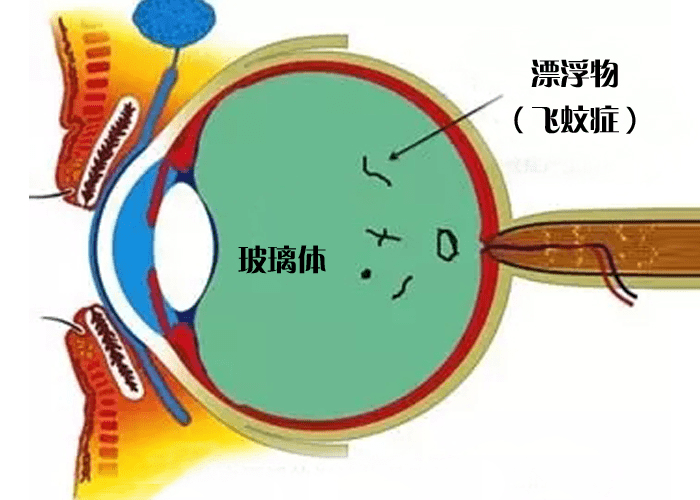 1046cad3ee6f40789ce1771249775a26.png