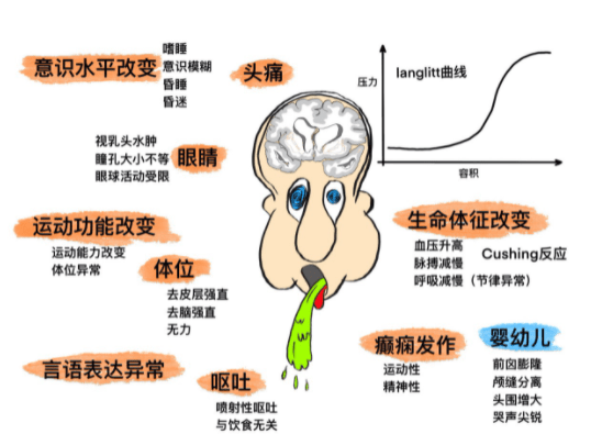 光纤压力传感器用于颅内压监测的效应