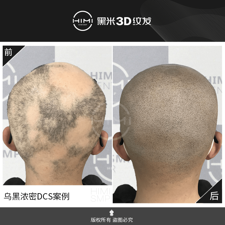 黑米3d纹发:纹发知识科普:3d纹发有哪些应用?