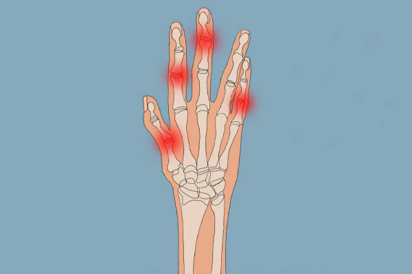 雄安祥和醫院幫你分析手指關節痛的這9種原因