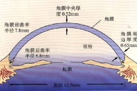 首大聂红平 什么是浅前房是由那些原因造成的 晶状体