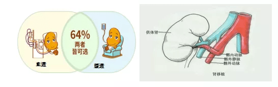 腹膜|慢性肾脏病患者的“持久战”——肾脏替代治疗