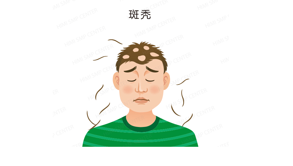 人群黑米3D纹发：纹发老师告诉你，哪些人群适合纹发？