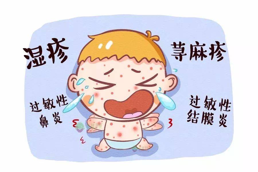 宝宝吃辅食后多久会出现过敏反应 9ffd6998a30f4ccba2e63832a9310a0b.jpeg