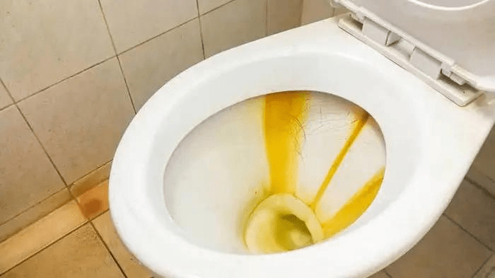 马桶经常刷怎么还变黄发臭