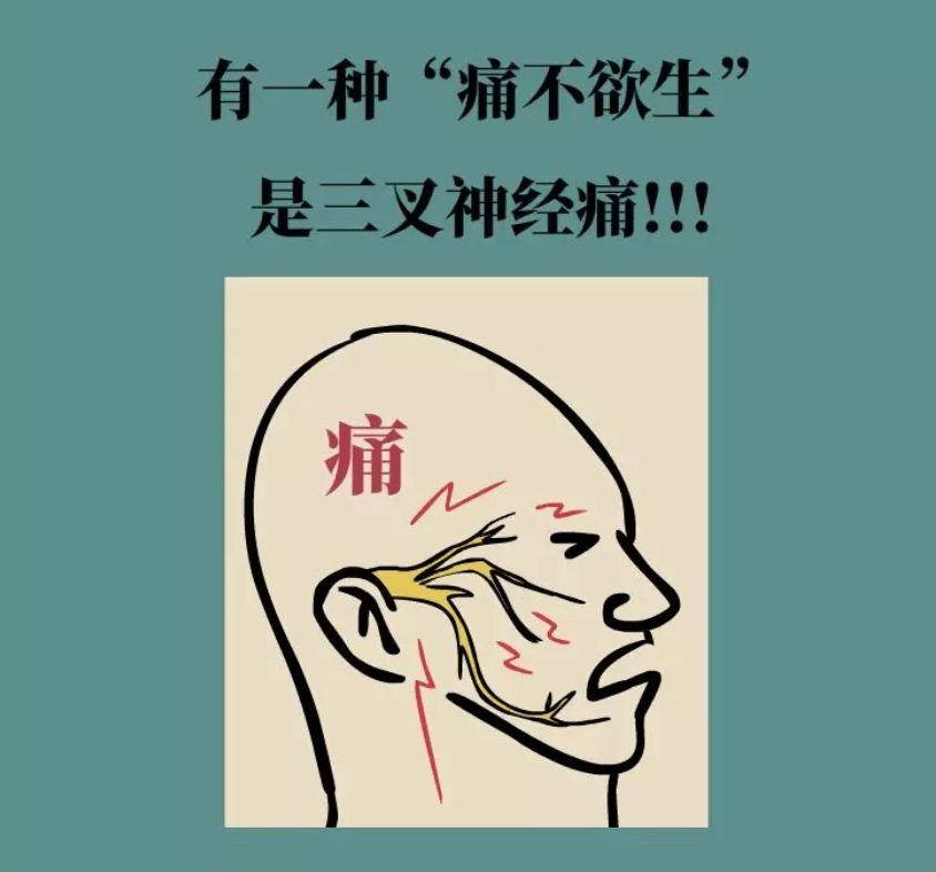 三叉神经痛特点有哪些?