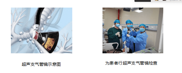 步伐|西安交大一附院东院区呼吸内科团队紧跟融合发展步伐 开展多项先进医疗技术