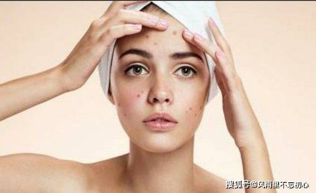 睡眠皙活:油性肌肤当然不会油一辈子!分享几条改善油肌的护肤建议!