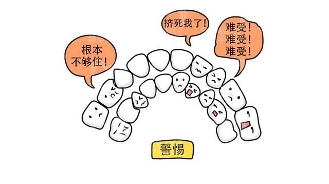 牙齿拥挤要进行治疗吗?