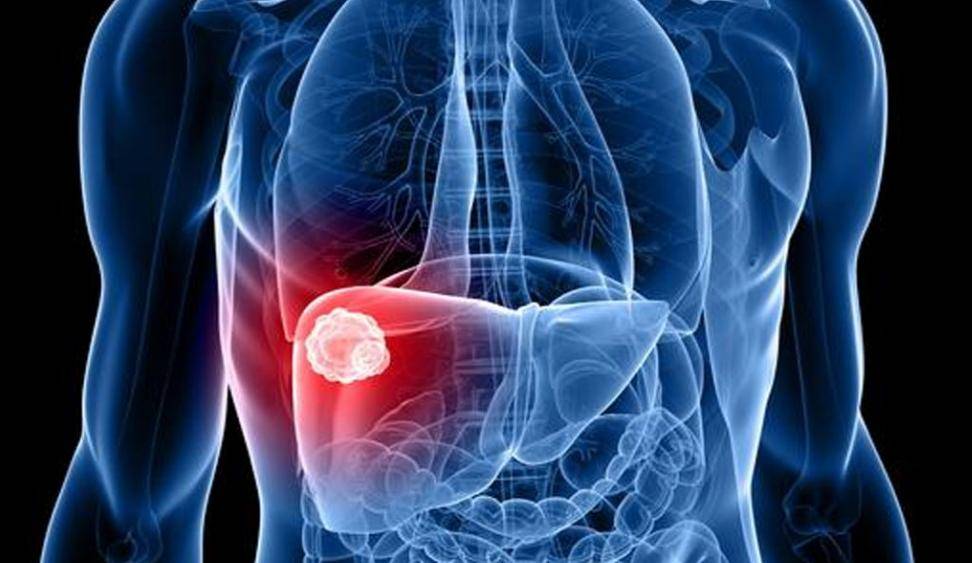 肝脏|乙肝的几大症状