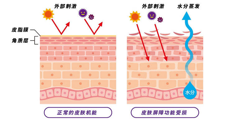 Stridex护肤小课堂——皮肤屏障受损