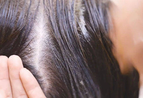 染发剂抛弃传统染发，统一植物养发？植物养发怎么样?